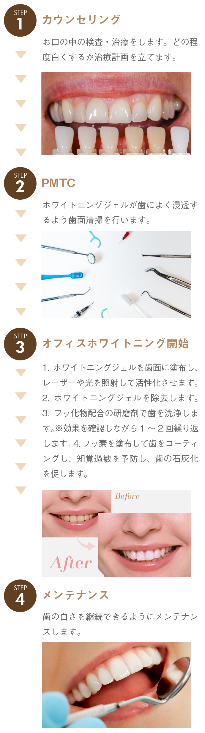 カウンセリングお口の中の検査・治療をします。どの程度白くするか治療計画を立てます。PMTCホワイトニングジェルが歯によく浸透するよう歯面清掃を行います。オフィスホワイトニング1.ホワイトニングジェルを歯面に塗布し、レーザーや光を照射して活性化させます。2.ホワイトニングジェルを除去します。3.フッ化物配合の研磨剤で歯を洗浄します。※効果を確認しながら1～2回繰り返します。4.フッ素を塗布して歯をコーティングし、知覚過敏を予防し、歯の石灰化を促します。メンテナンス歯の白さを継続できるようにメンテナンスします。